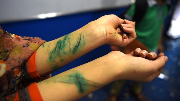 یک دختر متعلم افغان، یک روز بعد از انفجاری که به تاریخ ۱۱سرطان به وقوع پیوست، زخمهای دستانش را نشان میدهد که بر اثر شیشه های شکسته در نزدیکی محل موتربمب در کابل برداشته بودند. [وکیل کوهسار\ای اف پی]