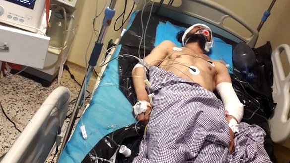 مردی که در یک انفجار در ولسوالی امام صاحب، ولایت کندز زخمی شده بود، به تاریخ ۲ ثور در یک شفاخانه در قندوز تداوی می شود. [ای اف پی]